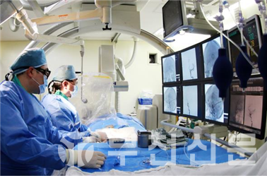 가톨릭대학교 부천성모병원 뇌졸중센터장 신경외과 김성림 교수(좌로부터 두 번째)가 뇌졸중환자에게 뇌혈관내수술을 시행하고 있다.